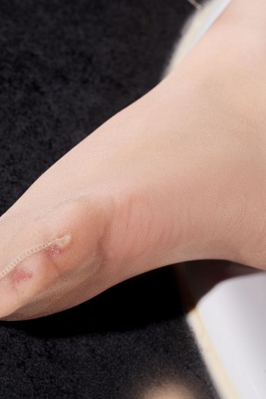 半岛平台在线登入|在整形求美过程中 需要谨慎注意(图1) 半岛(中国)